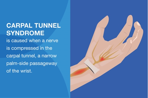 5 carpal tunnel relief products you need at work